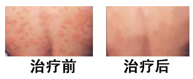 皮肤治疗仪都有哪些南昌中山皮肤病医院性病诊疗中心，网上预约短信凭证_https://www.jmylbn.com_新闻资讯_第14张