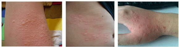 皮肤治疗仪都有哪些南昌中山皮肤病医院性病诊疗中心，网上预约短信凭证_https://www.jmylbn.com_新闻资讯_第5张