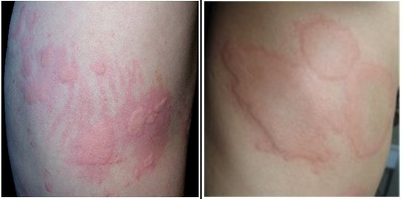 皮肤治疗仪都有哪些南昌中山皮肤病医院性病诊疗中心，网上预约短信凭证_https://www.jmylbn.com_新闻资讯_第8张